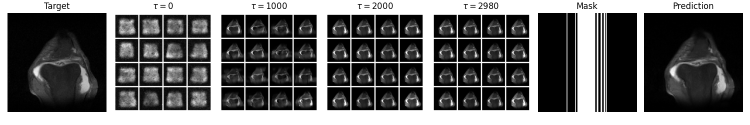 FastMRI