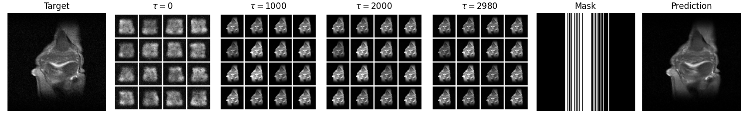 FastMRI